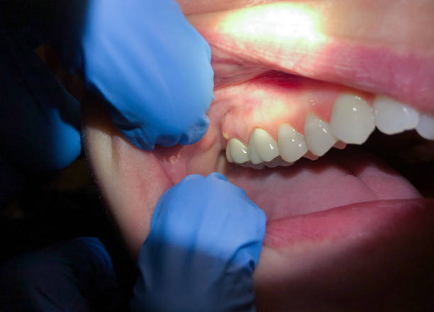 Best Pediatric Emergency Dentist in Shadyside, OH